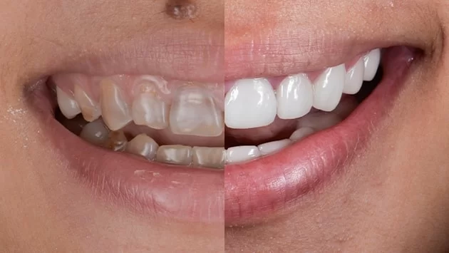 x dentistry antes y despues de 3 sobre 6 01
