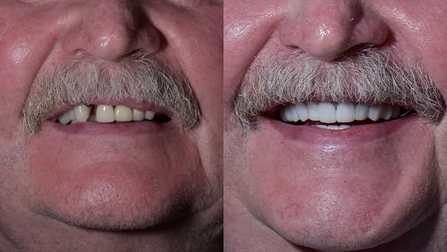 x dentistry antes y despues de 3 sobre 6 02