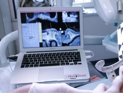 x dentistry 3 on 6 navident