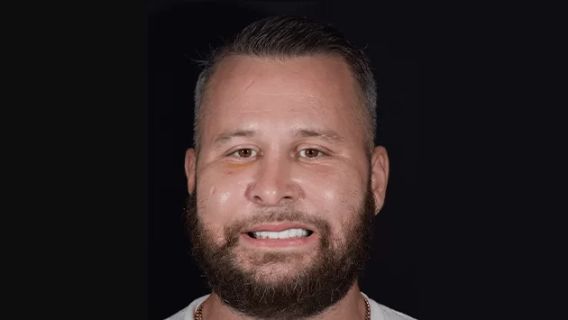 xdentistry paciente all on 4 01