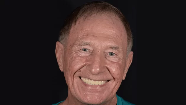 xdentistry paciente all on 4 03