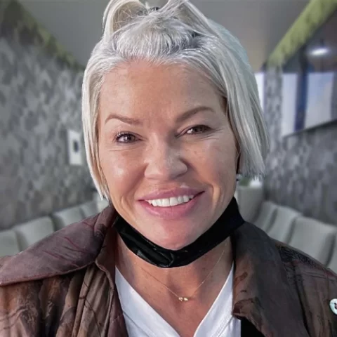 Paciente dentista posterior a revision 02