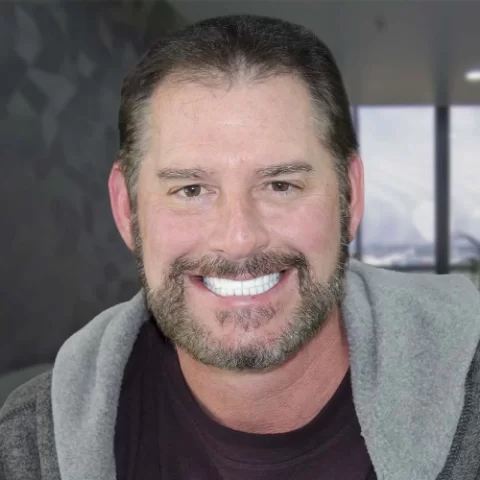 Paciente dentista posterior a revision 03