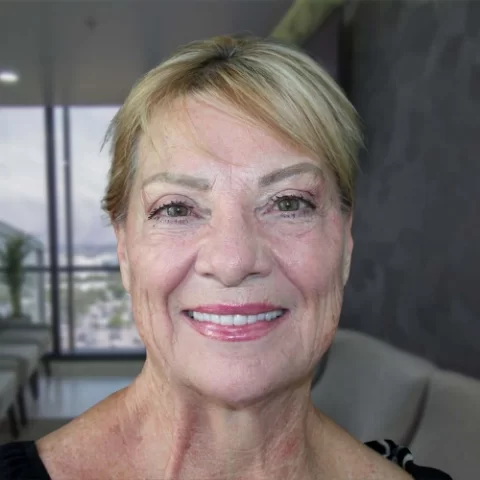 Paciente dentista posterior a revision 04