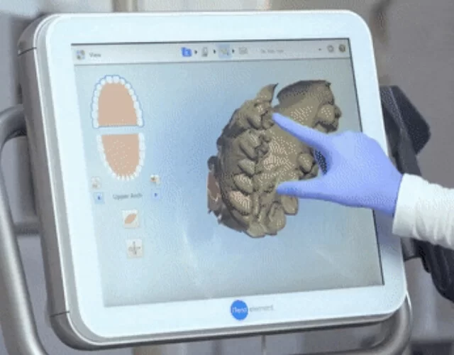 tecnologia dental itero tijuana